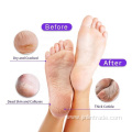 Natural Dead Skin Remover Magic Foot mask